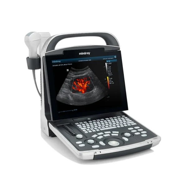 ecografo mindray dp 30
